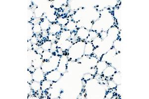 Immunohistochemistry of paraffin embedded mouse lung using UBE3A (ABIN7076104) at dilution of 1:1000 (400x lens) (ube3a 抗体)