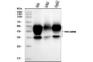 Western blot analysis of CD147/Emmprin using anti-CD147/Emmprin antibody (ABIN7599999).
