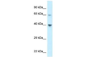 Western Blot showing CCRL1 antibody used at a concentration of 1 ug/ml against 293T Cell Lysate (CCRL1 抗体  (C-Term))