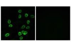 Immunofluorescence analysis of A549 cells, using ATP5G3 antibody. (ATP5G3 抗体)