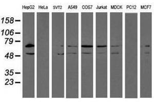 Image no. 2 for anti-Protein Disulfide Isomerase Family A, Member 4 (PDIA4) antibody (ABIN1500106) (PDIA4 抗体)