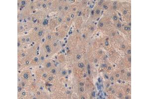 Used in DAB staining on fromalin fixed paraffin- embedded Kidney tissue (BCL10 抗体  (AA 1-233))