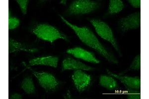 Immunofluorescence of monoclonal antibody to ALG6 on HeLa cell. (ALG6 抗体  (AA 25-114))