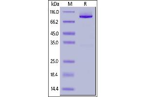 Human Glypican 1, Fc Tag on  under reducing (R) condition.
