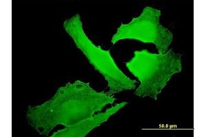 Immunofluorescence of monoclonal antibody to EPB41 on HeLa cell.