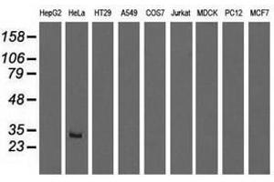 Image no. 1 for anti-Glutathione S-Transferase theta 2 (GSTT2) antibody (ABIN1498559) (GSTT2 抗体)