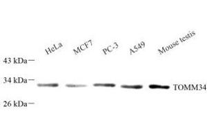 Western blot analysis of TOMM34 (ABIN7075984) at dilution of 1: 1000 (TOMM34 抗体)