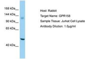 Image no. 1 for anti-G Protein-Coupled Receptor 158 (GPR158) (AA 1120-1169) antibody (ABIN6750189)
