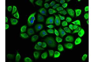 Immunofluorescence staining of Hela cells with ABIN7147101 at 1:33, counter-stained with DAPI. (CNOT3 抗体  (AA 257-395))