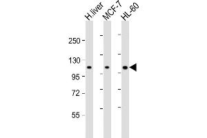 All lanes : Anti-RSBN1 Antibody (N-term) at 1:2000 dilution Lane 1: human liver lysate Lane 2: MCF-7 whole cell lysate Lane 3: HL-60 whole cell lysate Lysates/proteins at 20 μg per lane. (RSBN1 抗体  (N-Term))