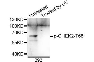 Western blot analysis of extracts of 293 cells, using Phospho-CHEK2-T68 antibody. (CHEK2 抗体  (pThr68))
