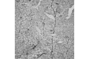 IHC on rat brain (paraffin sections) using Rabbit antibody to RhoA   at a concentration of 15 µg/ml, incubated overnight and developed with DAB Ni. (RHOA 抗体  (AA 100-150))