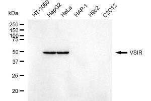 Western blotting analysis using VSIR antibody (ABIN7800808).