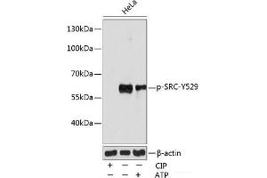 Western blot analysis of extracts of various cell lines using Phospho-SRC(Y529) Polyclonal Antibody at dilution of 1:1000. (Src 抗体  (pTyr529))