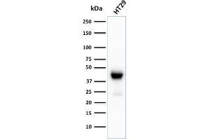 Western Blot Analysis of HT29 cell lysate using CK20 Recombinant Rabbit Monoclonal Antibody (KRT20/3129R). (Recombinant KRT20 抗体  (AA 196-323))