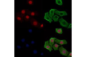 ABIN6254871 and ABIN6274016 staining Hela cells(heat shock treatment) by IF/ICC. (Histone H2A 抗体  (acLys9))