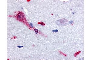 Anti-TAAR1 antibody IHC of human brain, amygdala. (TAAR1 抗体  (Cytoplasmic Domain))