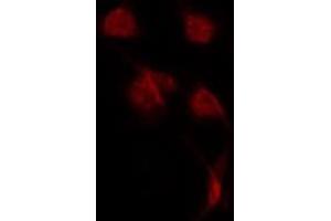 ABIN6275656 staining LOVO by IF/ICC. (USP42 抗体  (Internal Region))