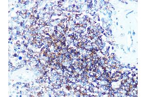 Immunohistochemistry of paraffin-embedded human spleen using CD20 Rabbit mAb (ABIN7268472) at dilution of 1:100 (40x lens).