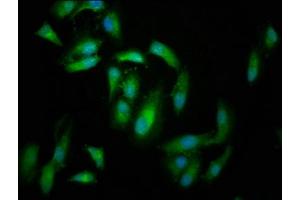 Immunofluorescence staining of Hela cells with ABIN7152702 at 1:166, counter-stained with DAPI. (FERMT2 抗体  (AA 155-232))