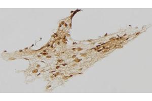 ABIN6273458 at 1/100 staining Human gastric tissue by IHC-P. (CENPI 抗体  (Internal Region))