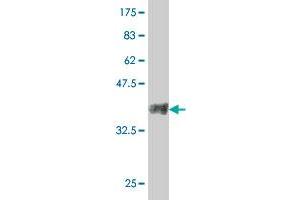 Western Blot detection against Immunogen (38. (Slc26a9 抗体  (AA 496-605))