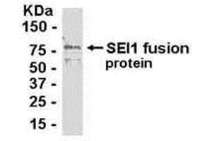 Western Blotting (WB) image for anti-SERTA Domain Containing 1 (SERTAD1) (AA 1-236) antibody (ABIN2468083) (SERTAD1 抗体  (AA 1-236))