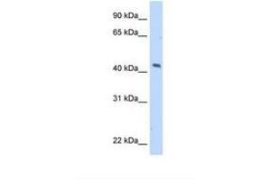 Image no. 1 for anti-Melanoma Antigen Family A, 1 (Directs Expression of Antigen MZ2-E) (MAGEA1) (AA 201-250) antibody (ABIN321051)