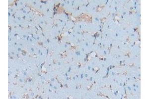 DAB staining on IHC-P; Samples: Rat Heart Tissue (S100A6 抗体  (AA 1-89))