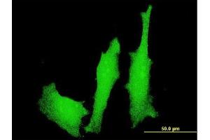 Immunofluorescence of monoclonal antibody to LMO4 on HeLa cell. (LMO4 抗体  (AA 1-165))