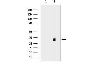 anti-Enoyl-CoA Delta Isomerase 1 (ECI1) (N-Term) antibody
