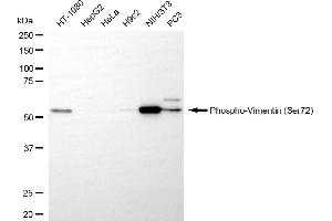 Western blotting analysis using phospho-vimentin (Ser72) antibody (ABIN7800835). (Recombinant Vimentin 抗体  (pSer72))