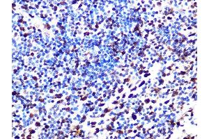 Immunohistochemistry of paraffin-embedded human appendix using S Rabbit mAb (ABIN7270142) at dilution of 1:100 (40x lens). (SAMHD1 抗体)