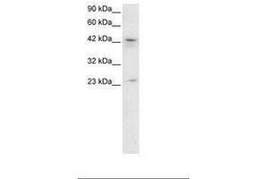 Image no. 2 for anti-Zinc Finger Protein 365 (ZNF365) (AA 33-82) antibody (ABIN6735800) (ZNF365 抗体  (AA 33-82))