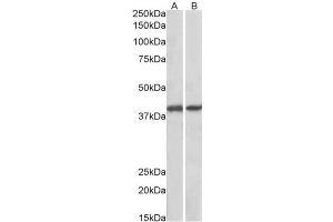 AP23750PU-N GNAQ antibody staining of Pig Colon (A) and Pig Spleen (B) lysates at 0. (GNAQ 抗体  (Internal Region))