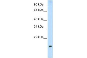 WB Suggested Anti-PPP1R8 Antibody Titration:  2. (PPP1R8 抗体  (Middle Region))