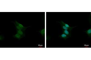 ICC/IF Image Calcineurin A antibody detects Calcineurin A protein at nucleus by immunofluorescent analysis. (Calcineurin A 抗体  (Center))