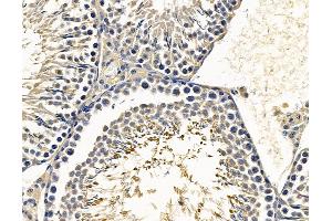 ABIN7096626 and ABIN7100690 at 1/100 staining rat testis tissue by IHC-P.