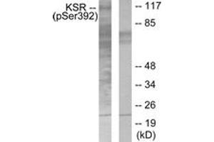 Western blot analysis of extracts from HepG2 cells, using KSR (Phospho-Ser392) Antibody. (KSR1 抗体  (pSer404))