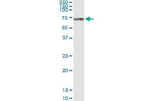 Immunoprecipitation of STK33 transfected lysate using anti-STK33 MaxPab rabbit polyclonal antibody and Protein A Magnetic Bead , and immunoblotted with STK33 purified MaxPab mouse polyclonal antibody (B01P) . (STK33 抗体  (AA 1-514))