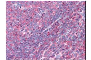 Human Tonsil: Formalin-Fixed, Paraffin-Embedded (FFPE) (FNBP1 抗体  (Internal Region))