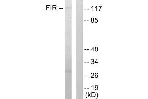 Western blot analysis of extracts from HuvEc cells, using FIR antibody. (FARP2 抗体  (Internal Region))
