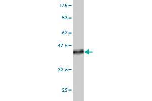 Western Blot detection against Immunogen (36. (LIM Domain Kinase 1 抗体  (AA 548-647))