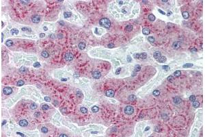 anti-Retinol Binding Protein 4, Plasma (RBP4) (AA 19-202) antibody