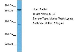 Host: Rabbit Target Name: CTCF Sample Tissue: Mouse Testis Antibody Dilution: 1ug/ml (CTCF 抗体  (C-Term))