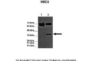 Lanes:   Lane 1: 15ug WT mouse ES lysate Lane 2: 15ug MBD2 KO mouse ES lysate  Primary Antibody Dilution:   1:1000  Secondary Antibody:   Goat anti-rabbit-HRP  Secondary Antibody Dilution:   1:2500  Gene Name:   MBD2 a  Submitted by:   Austin J. (MBD2 抗体  (N-Term))