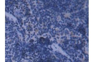 Immunohistochemistry (IHC) image for anti-Ferritin, Light Polypeptide (FTL) (AA 5-183) antibody (ABIN1868055)