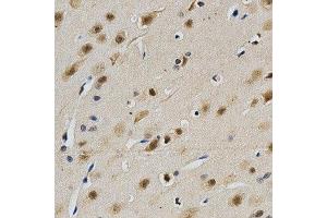 Immunohistochemistry of paraffin-embedded rat brain using LGALS3 antibody at dilution of 1:200 (x40 lens) (Galectin 3 抗体)