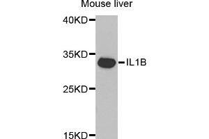 Western blot analysis of extracts of mouse liver, using IL1B antibody (ABIN5970463) at 1/1000 dilution. (IL-1 beta 抗体)