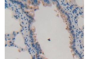 Immunohistochemistry (IHC) image for anti-Glutathione S-Transferase alpha 4 (GSTA4) (AA 2-222) antibody (ABIN7442771)